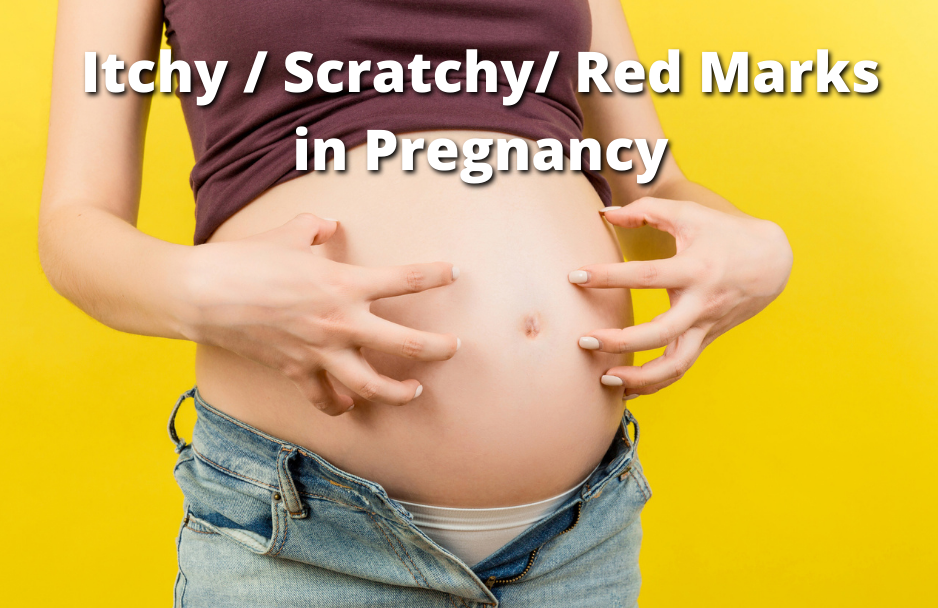 Itchy / scratchy/ Red marks in Pregnancy