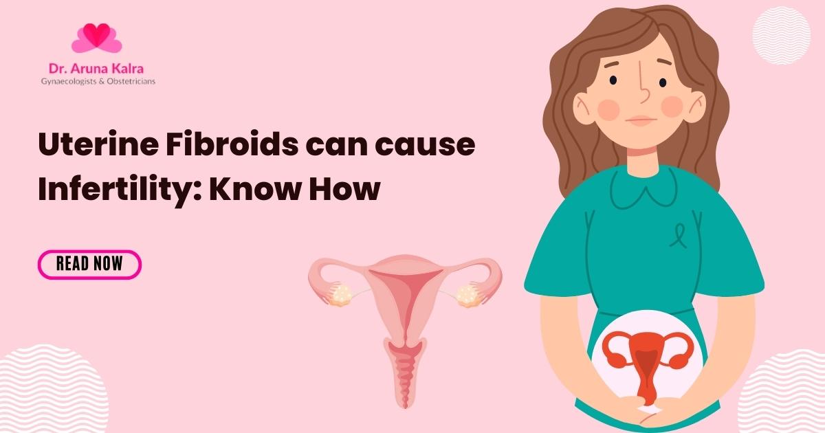 Uterine Fibroids Can Cause Infertility: Know How