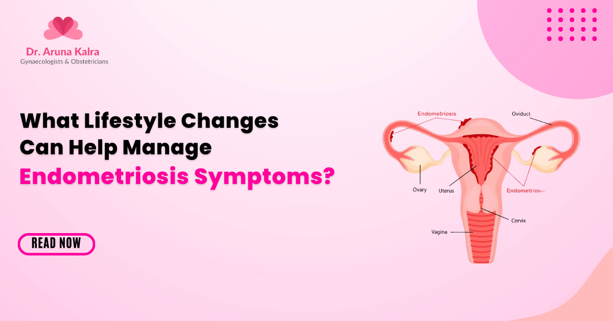 What Lifestyle Changes Can Help Manage Endometriosis Symptoms?
