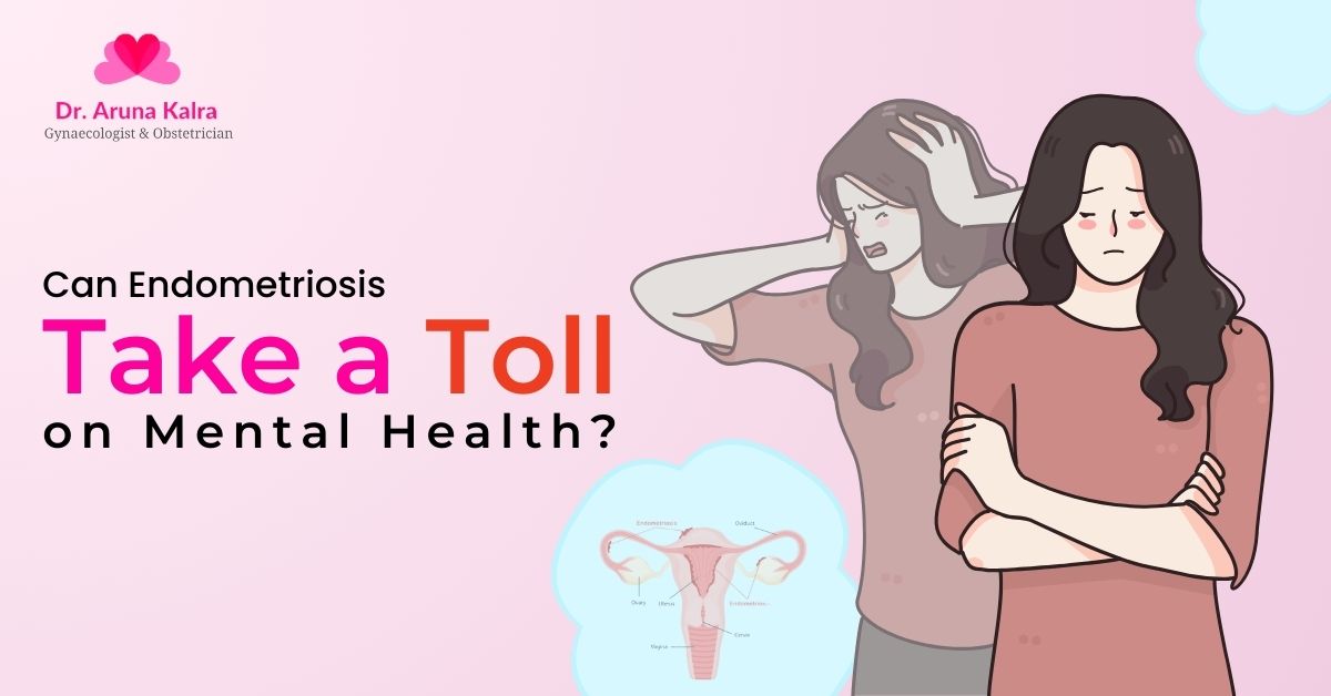 Can Endometriosis Take a Toll on Mental Health?