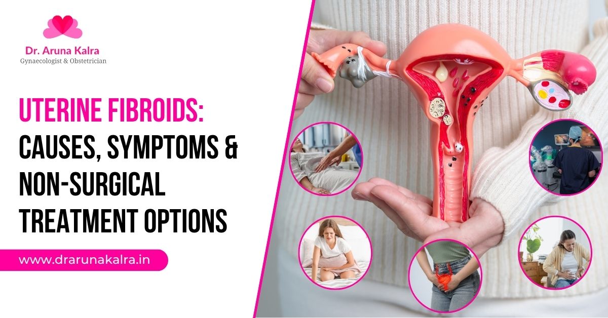 Uterine Fibroids