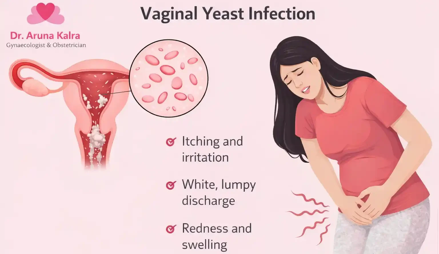 Vaginal Yeast Infection