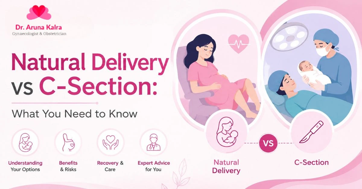 Natural Delivery vs C-Section What You Need to Know