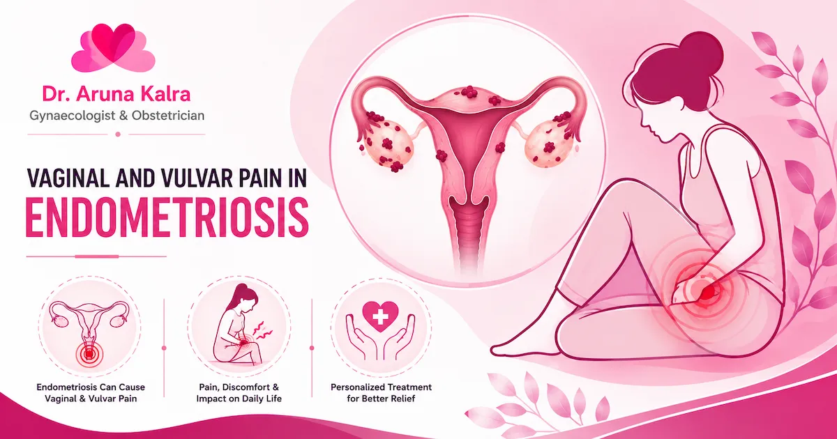 Vaginal and Vulvar Pain in Endometriosis Causes, Symptoms, and Treatment